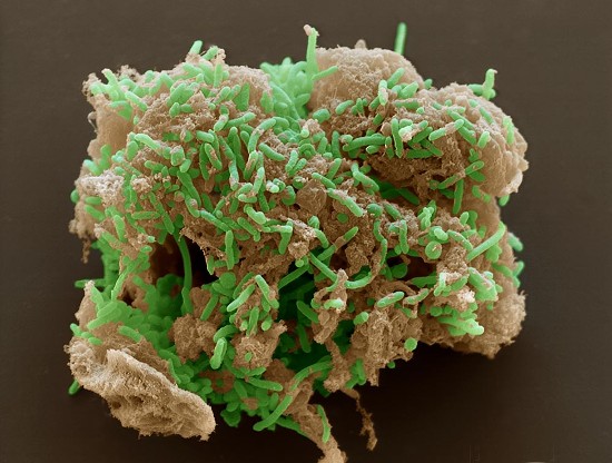 La bacteria Geobacter metallireducens (en verde) devorando material toxico radiactivo (ampliada 3600 veces)